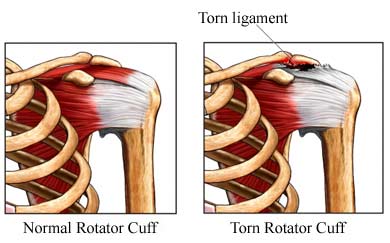 shoulder graphic